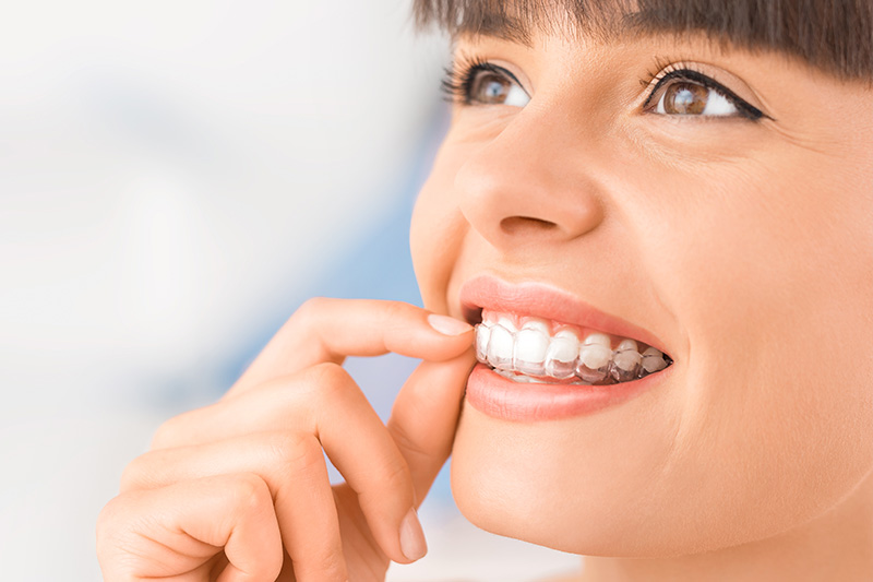 Invisalign in Woonsocket